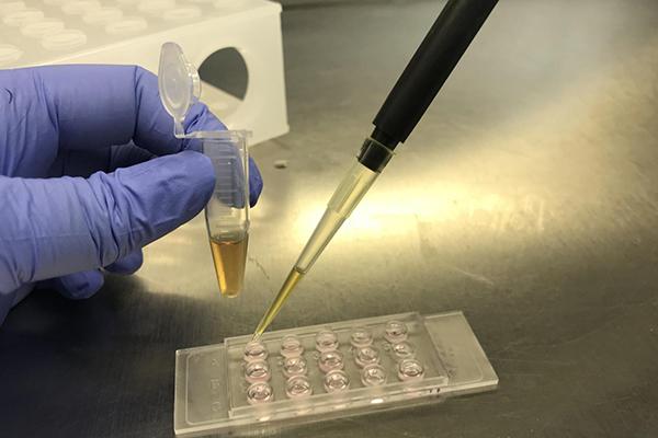 H2S oxidation reaction inside cells by using polymeric micelles